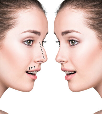 Nose Injection