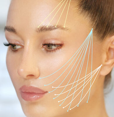 Face lifting without surgery