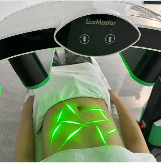 Lipo Laser