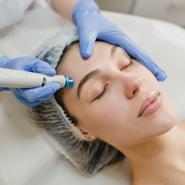 Microneedling